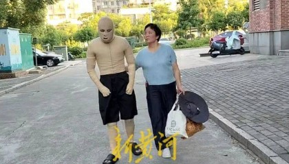 大学生因室友电动车燃爆,全身90%烧伤,治疗已花了290万元