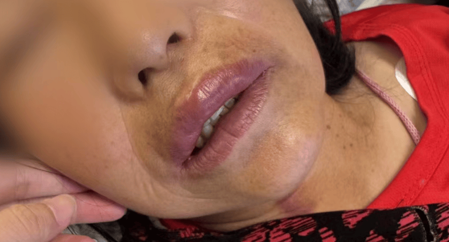 “差点要我命了!”杭州女子在阳台上被突袭!台风前后高发,千万当心,赶紧提醒家人