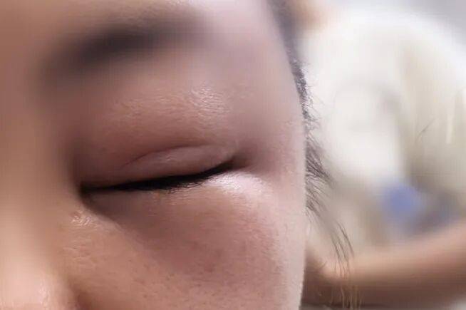 “差点要我命了!”杭州女子在阳台上被突袭!台风前后高发,千万当心,赶紧提醒家人